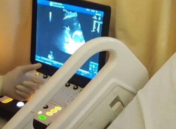 طفل يعود للحركة وشاب يتنفس بسهولة.. تقنية حديثة تنقذ حالتين بمستشفى العدوة