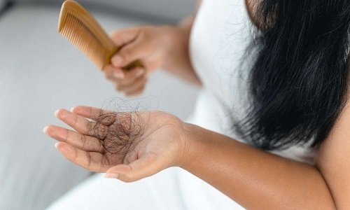 أفضل 10 شامبو ضد تساقط الشعر طبي وأكثر مبيعاً في لبنان 2025