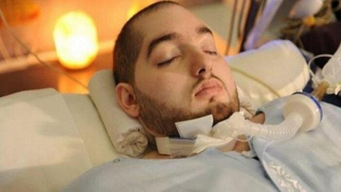 بعد وفاة الأمير النائم «الوليد بن خالد».. ما هي أسباب غيبوبة الدماغ؟