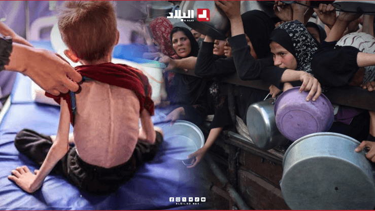 غزة تموت جوعًا.. مشاهد تُجسّد الكارثة الإنسانية الأفظع في العصر الحديث