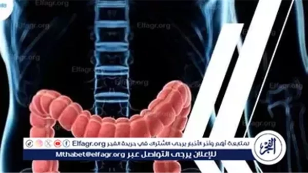 علامات تحذيرية لسرطان القولون تظهر خلال تناول الطعام.. تعرف عليها وطرق الوقاية
