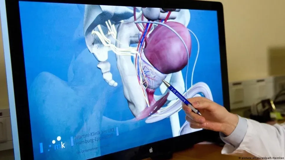 تمارين رياضية تقلل من خطر الإصابة بسرطان البروستات