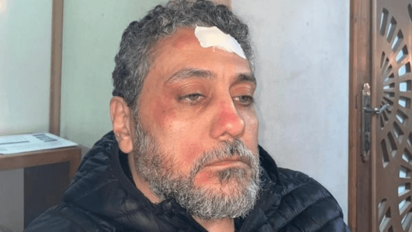 إصابة تامر فرج أثناء تصوير مسلسل "شهادة معاملة أطفال" (صور)