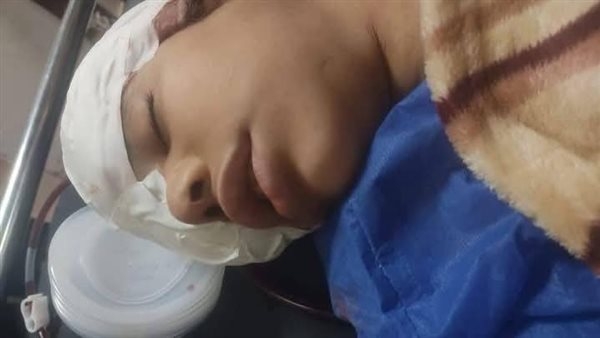 «حرب الطوب» وراء فقد طفلة من ذوى الهمم عينها أثناء ركوبها قطار«أشمون»