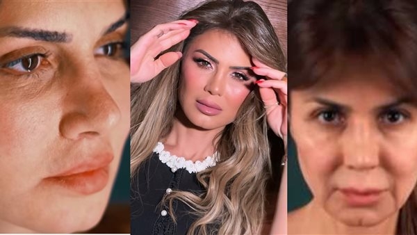 نجلاء بدر تثير الجدل بعد خضوعها لإجراء تجميلي.. وتعلق: رجعت زي زمان