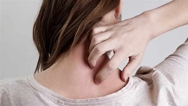 علامات خفية على البشرة تشير إلى الإصابة بداء السكري