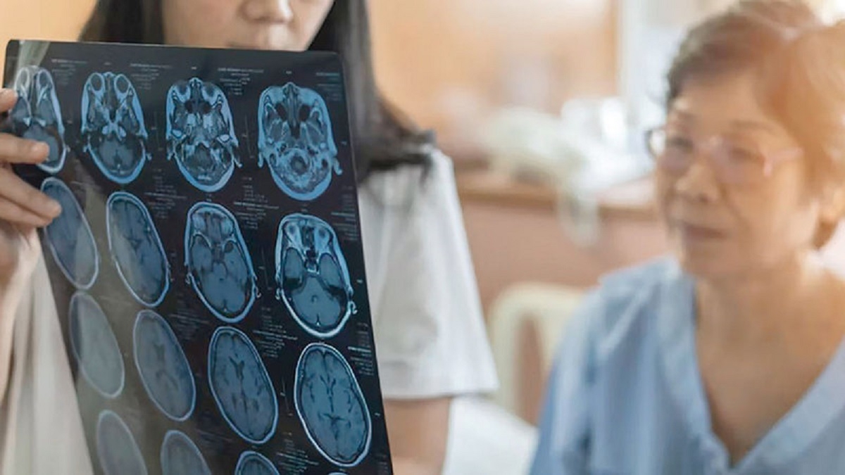 أعراض الإصابة بالزهايمر المبكر في منتصف العمر.. هل النسيان ناقوس خطر؟