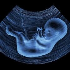 الذكاء الاصطناعي يمكنه كشف تشوهات الحمل في مرحلة مبكرة