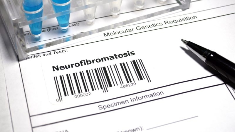 Bulgarian court ruling widens access to lifesaving drugs