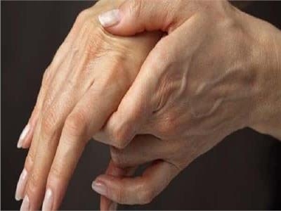 لقاح نانوي جديد يمنح الأمل في مكافحة تصلب الشرايين