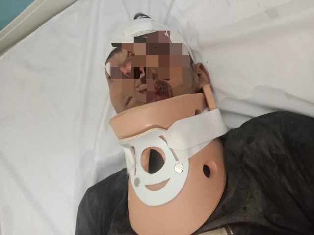 صحة الدقهلية: نجاح جراحة دقيقة لإصلاح كسر بالرقبة في تمى الأمديد