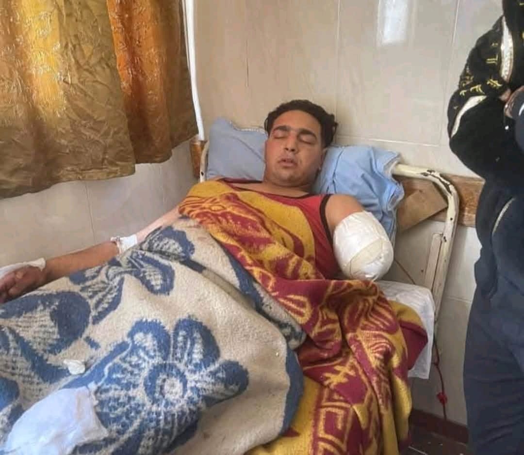 تفاصيل صادمة من شهود العيان بعد بتر ذراع العامل في سيرك طنطا