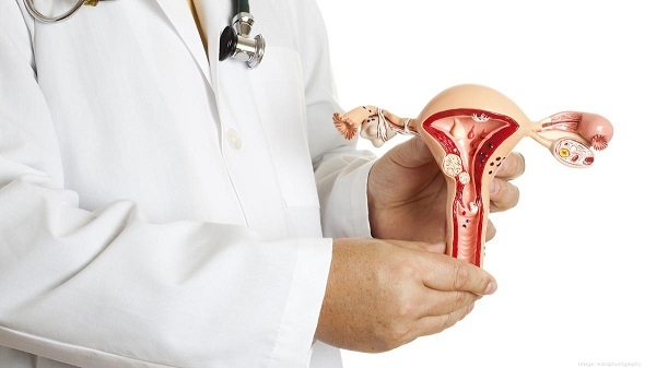 أكياس المبيض أثناء الحمل.. هل هي خطيرة؟