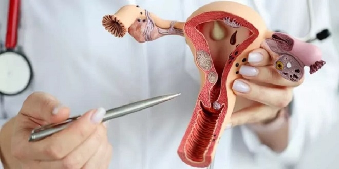 منها سرطان المبيض .. 3 أمراض صامتة لدى النساء قد تتحول إلى قاتلة