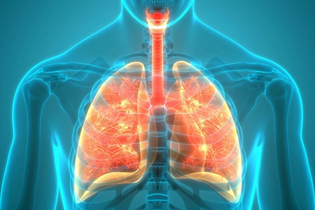 Most COVID Lung Abnormalities Heal Over Time, New Guidelines Confirm