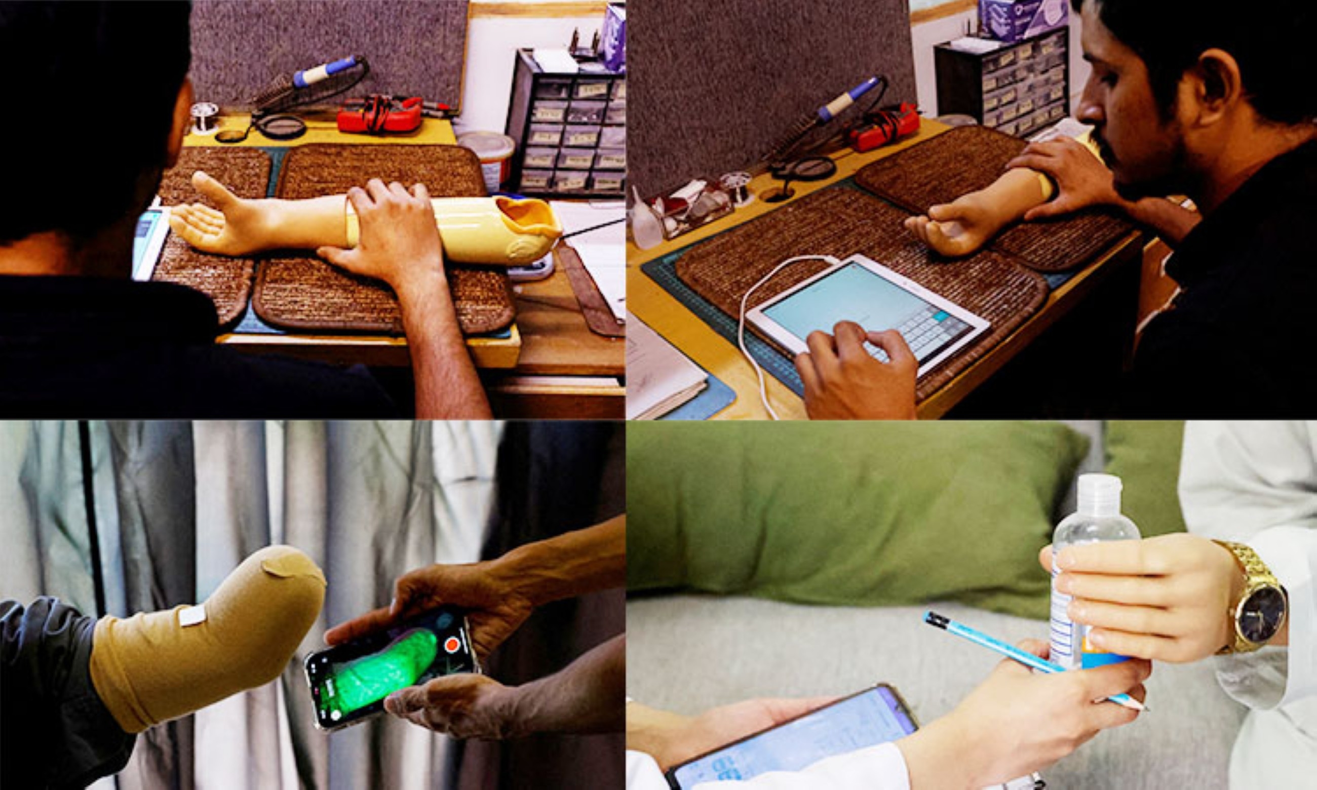 From Karachi to Gaza: Pakistani startup enlivens Palestinian child amputees with prosthetics