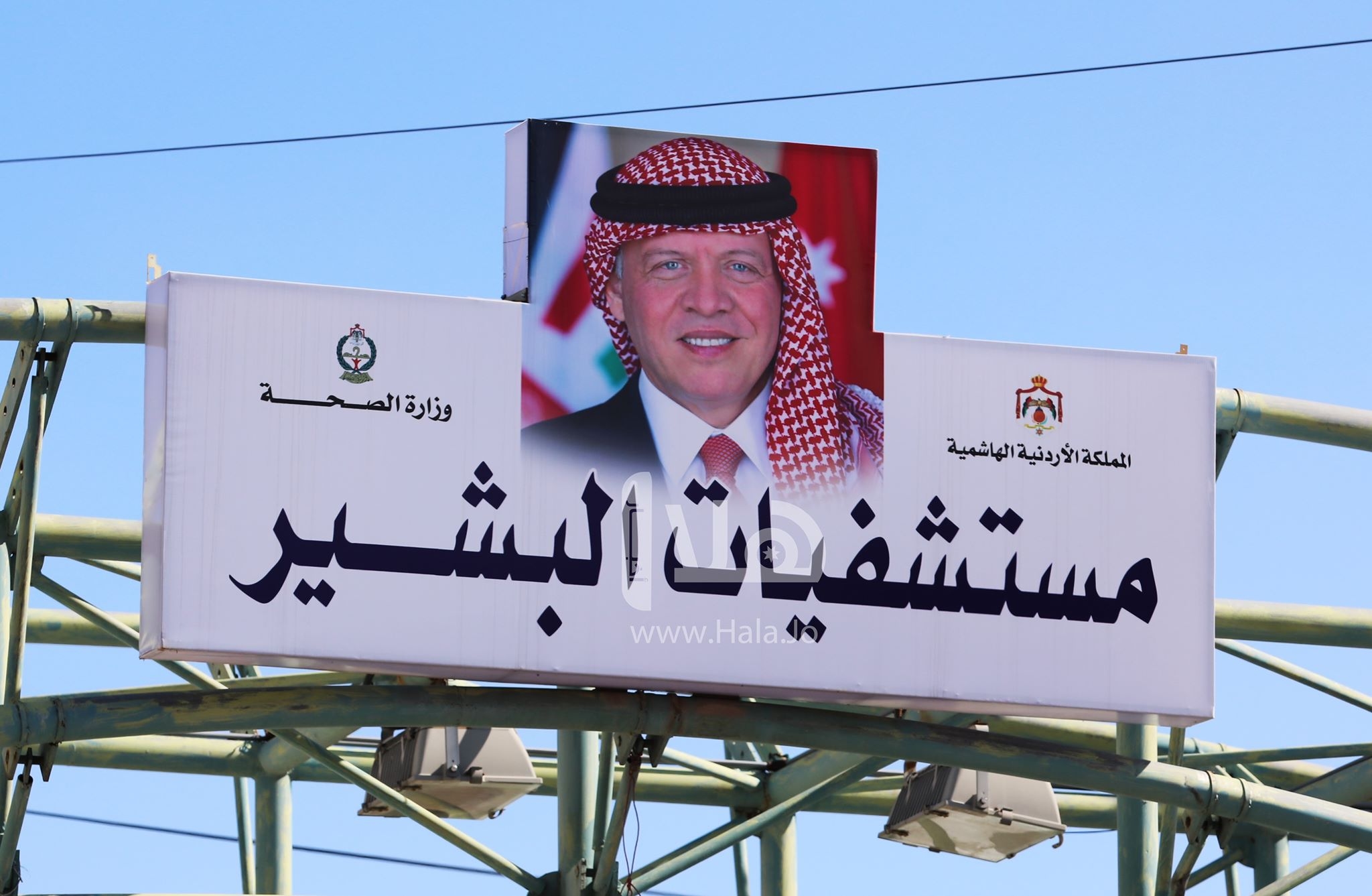 'البشير' تدخل جراحات دقيقة لعلاج التشوهات الشريانية الدماغية