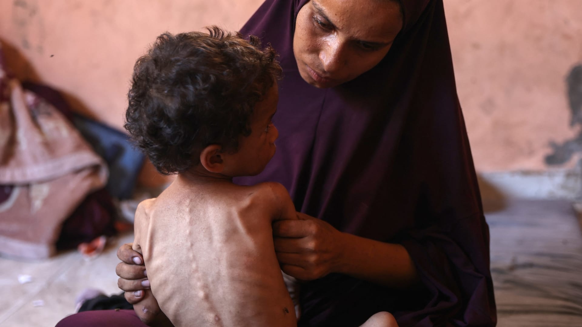 إسبانيا: المجاعة في غزة جراء الحصار الإسرائيلي مدعاة للخجل