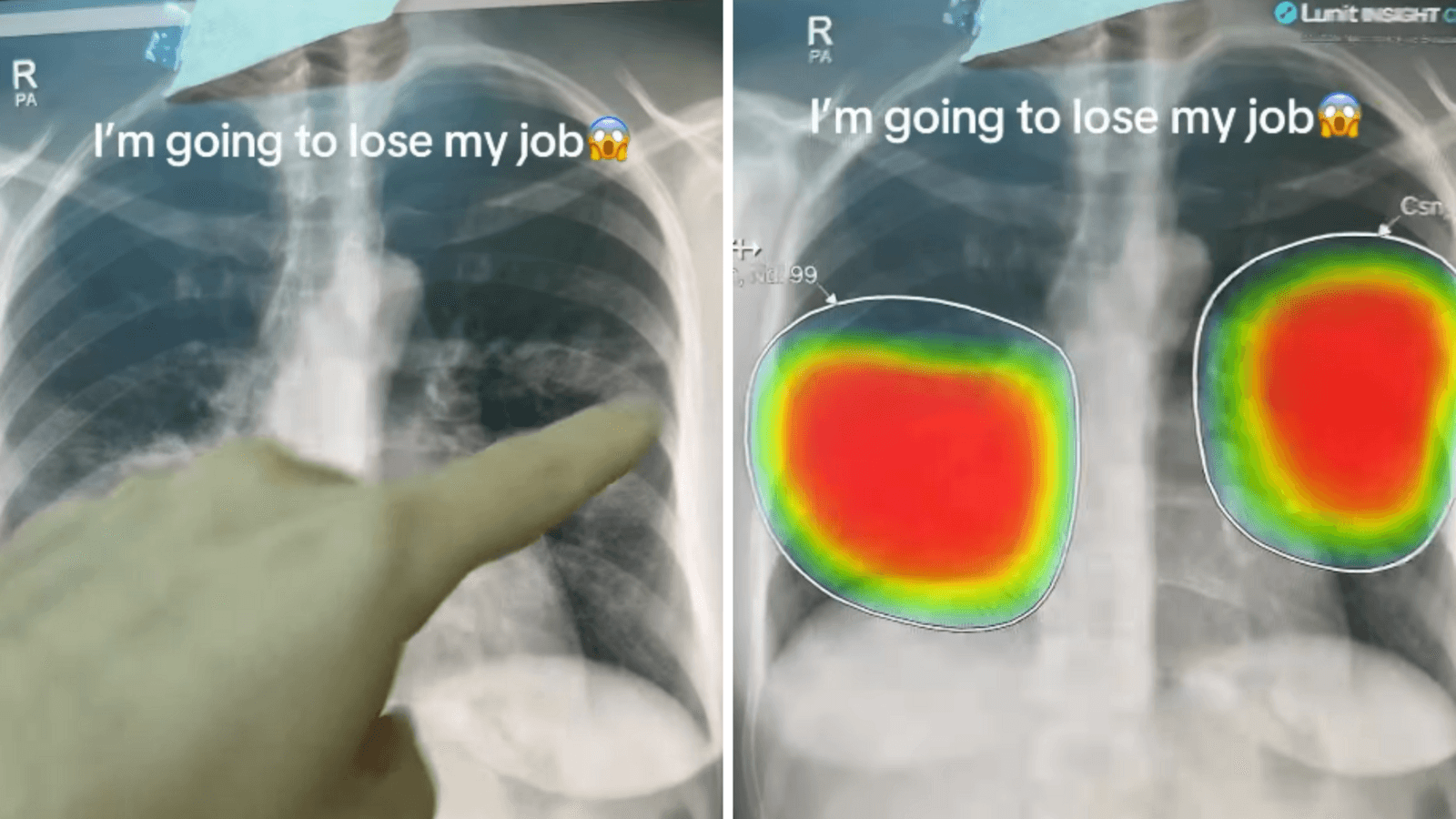 Dubai doctor says he might lose his job after AI analyses X-ray in seconds: 'I am applying to McDonald's'