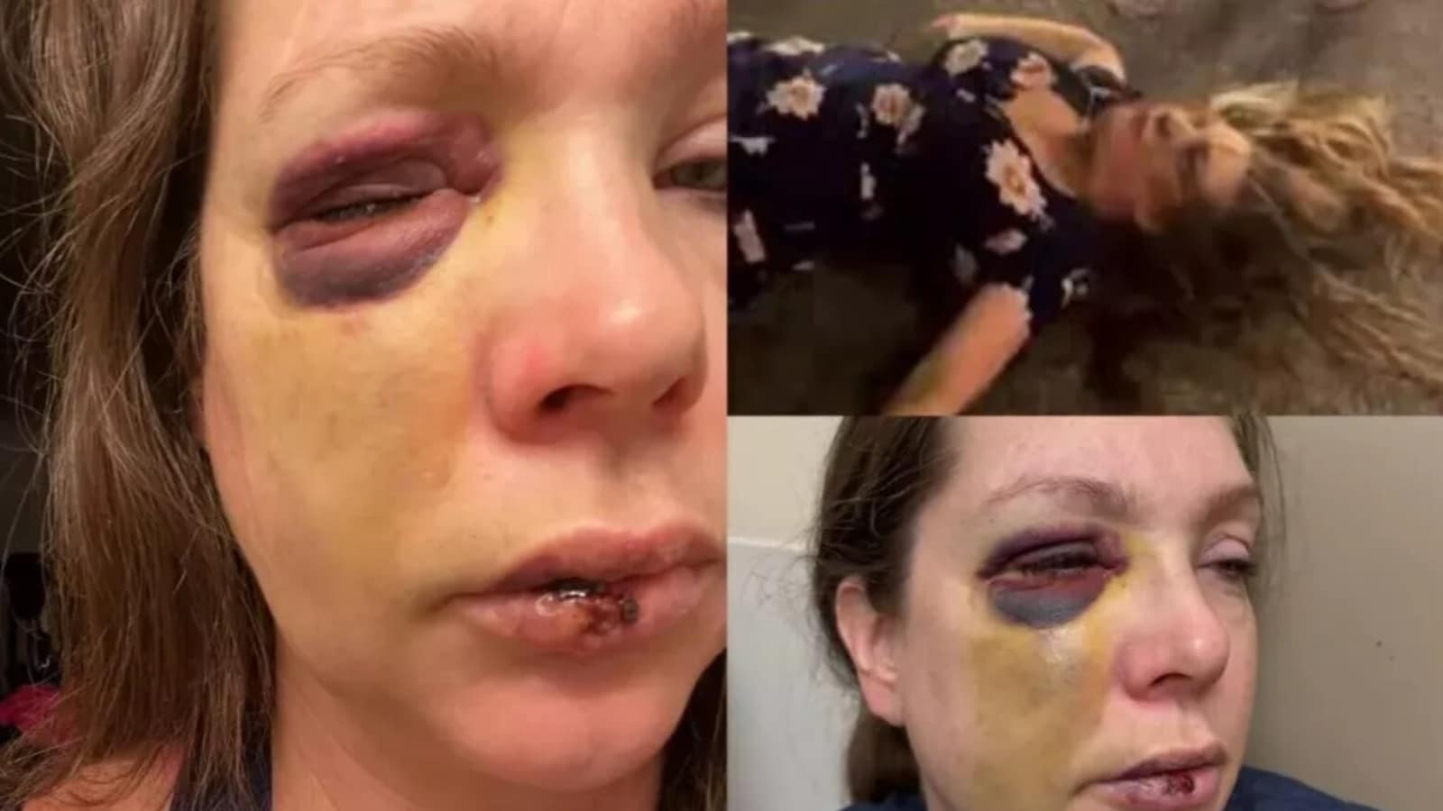 'Bad brain trauma': Cincinnati violence victim Holly gets GiveSendGo campaign; Vivek Ramaswamy donates $5000