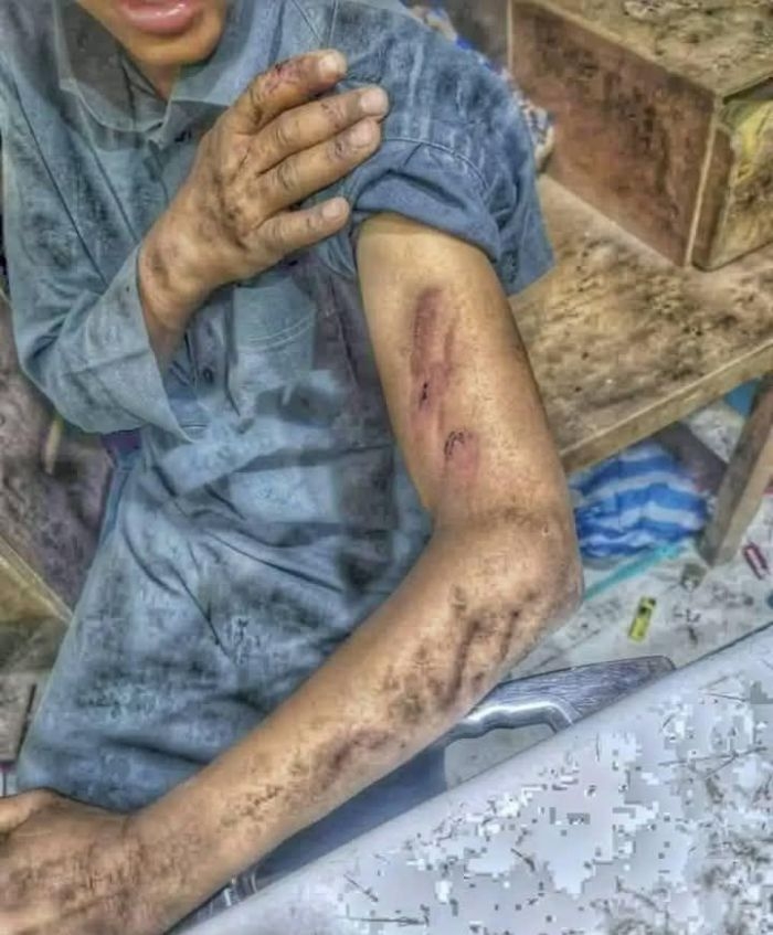 الأجهزة الأمنية تضبط متهمين بجرائم عنف أسري مروعة في مأرب وأبين