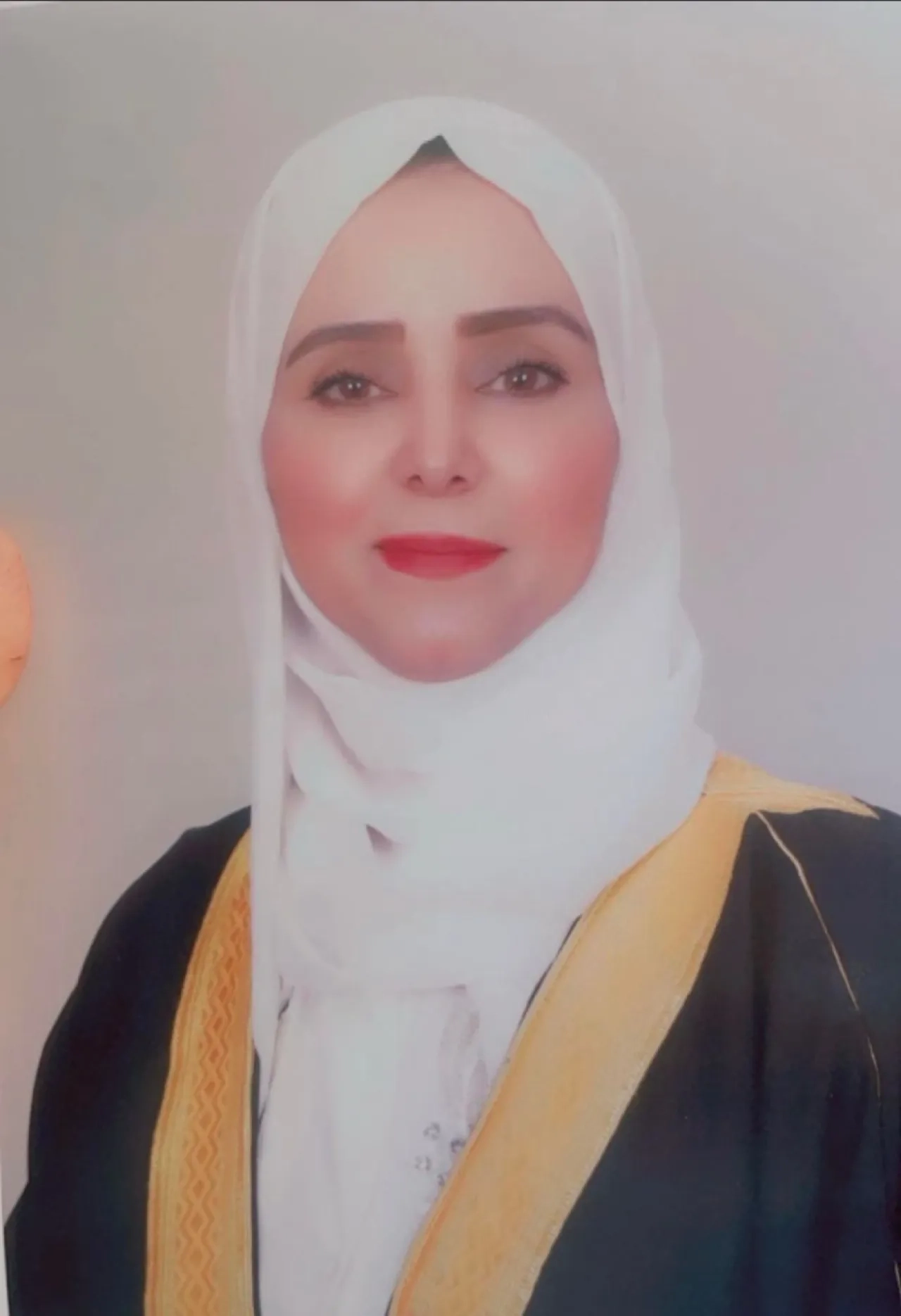 ذوو الإعاقة ( مبتوري الأطراف ) تحديدًا
