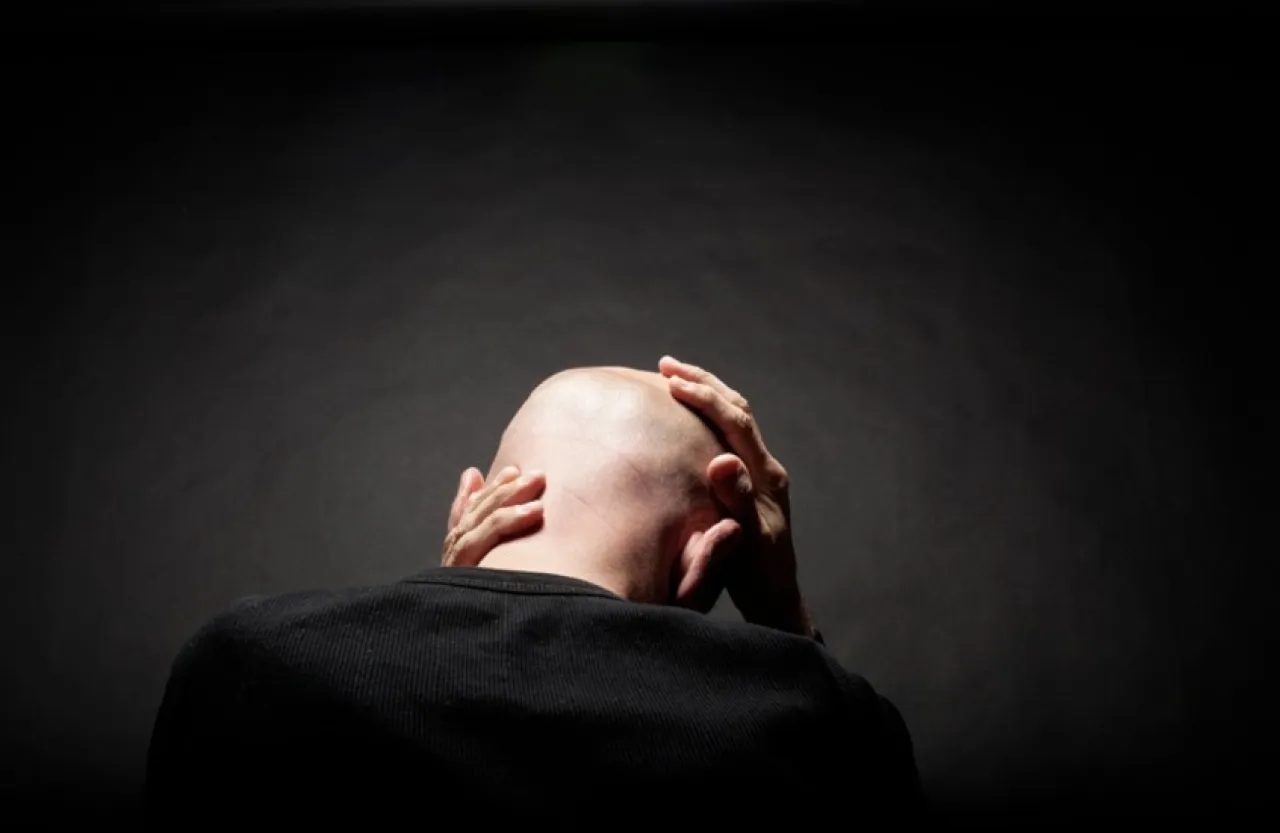 اختراق في علاج الصلع والنتائج خلال شهرين