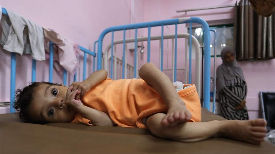 MSF says quarter of Gaza's young children malnourished