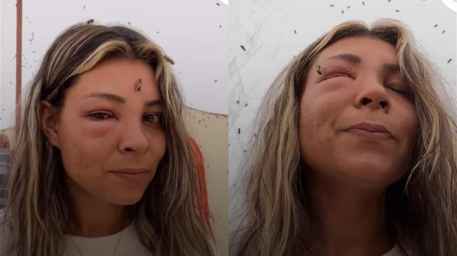 بهدوء مدهش... امرأة تُحاصرها مئات النحلات داخل خيمة دون أن تتحرك! (فيديو)