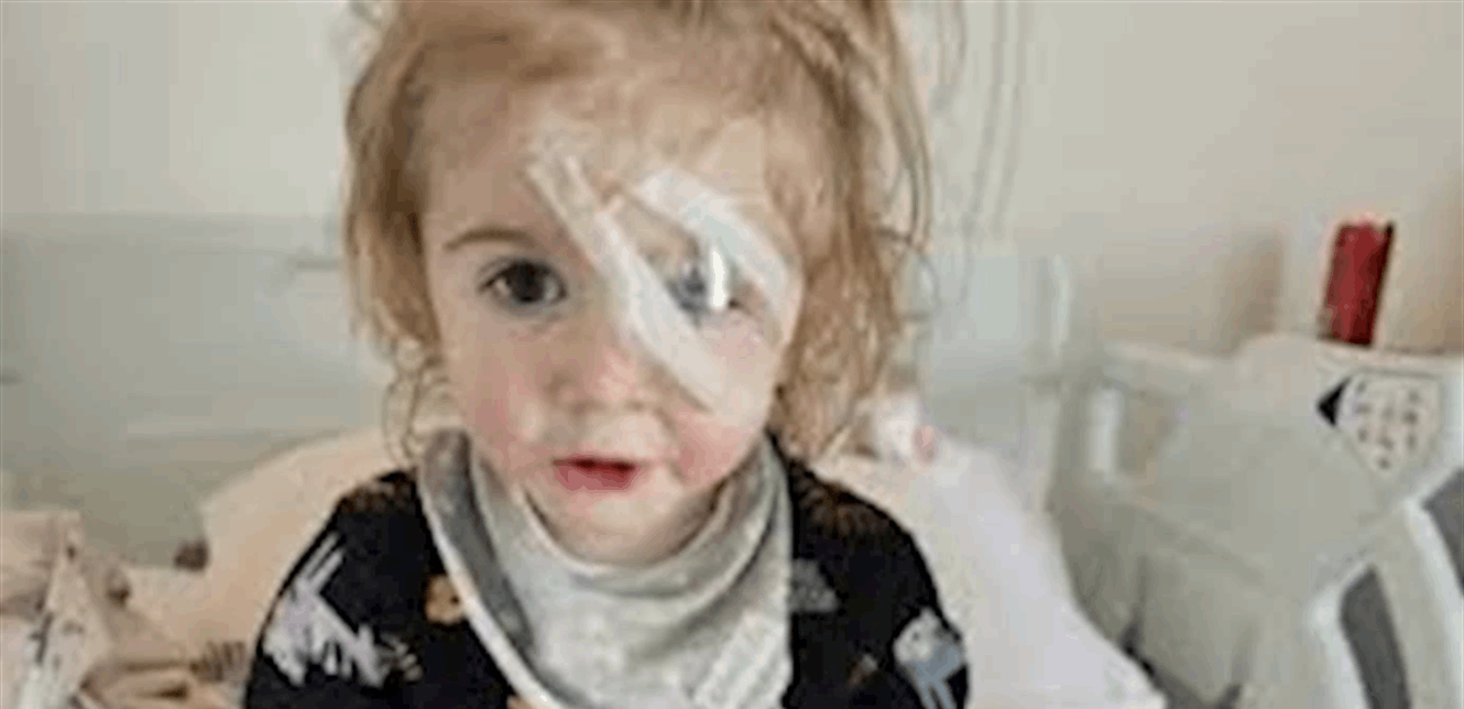بسبب قبلة.. طفل يفقد عينه
