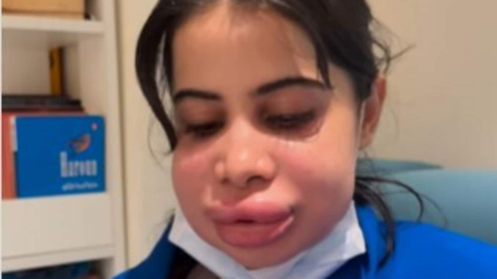 Uorfi Javed breaks silence after being trolled for swollen face from lip filler removal