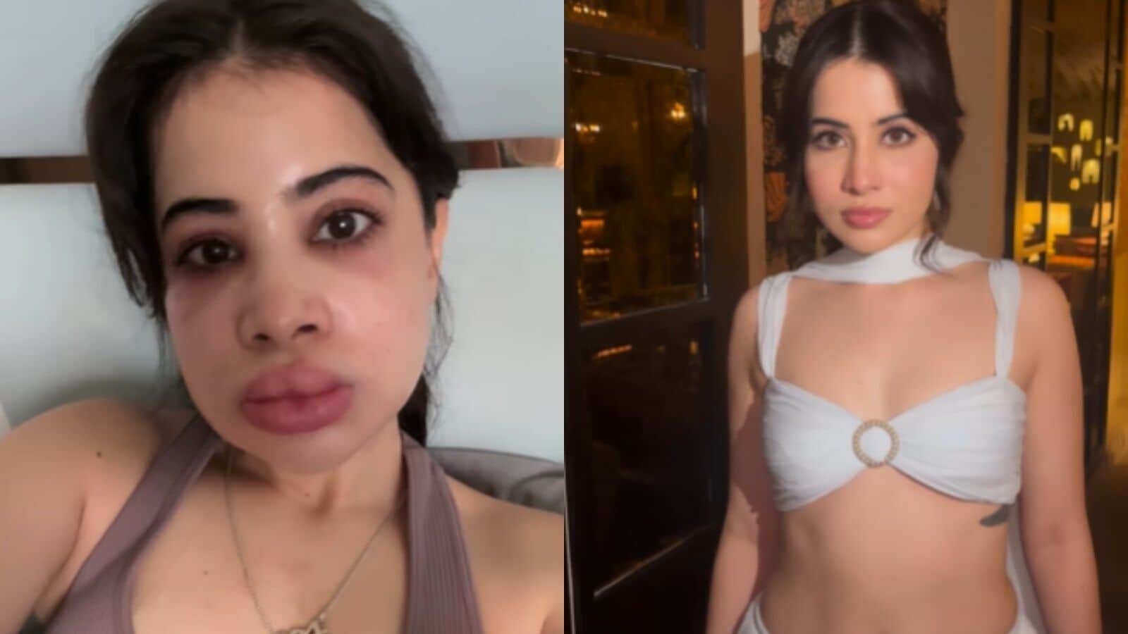 Uorfi Javed shares new look after dissolving lip fillers, netizens say ‘you've become prettier'