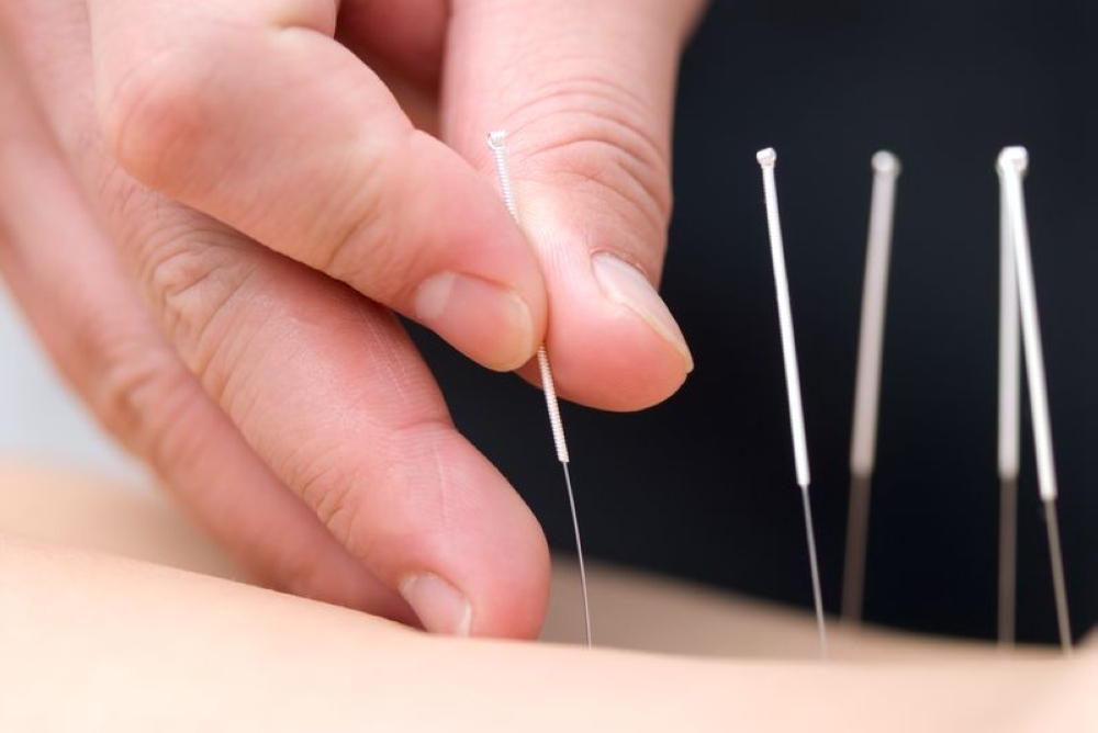 ‘Flesh-eating infection' after acupuncture for back sprain costs Hong Kong man his leg