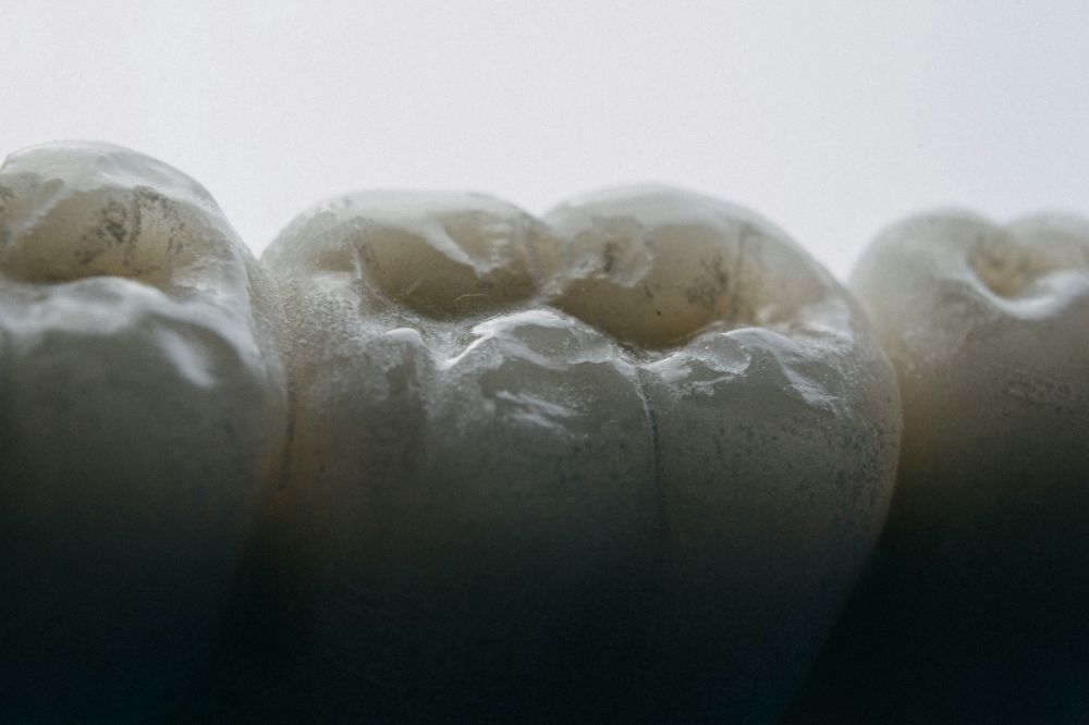 Teeth hurt? It could be because of a 500-million-year-old fish