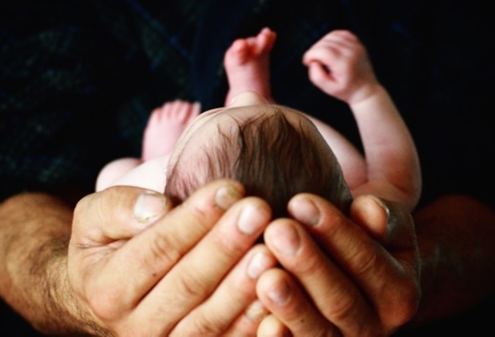 Superhero parents raising children with cleft lip and palate — Aufa Dahlia Bahar and Noorhidayah Zainal Aalam