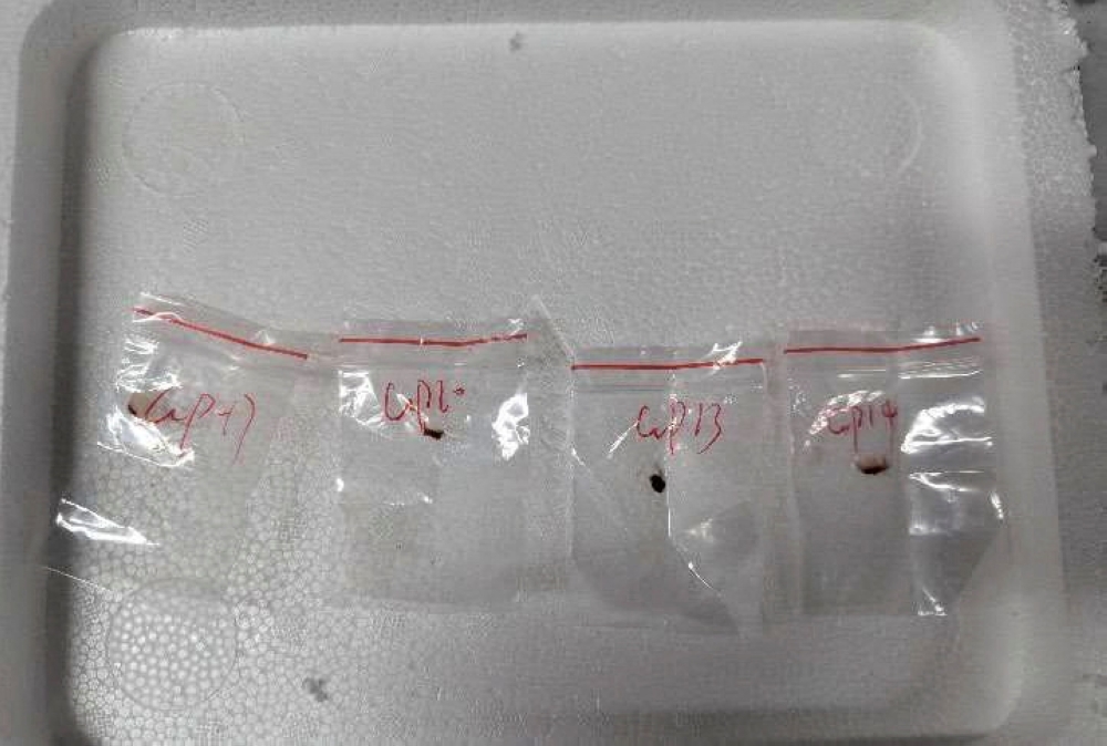 Bail hearing set for Chinese researcher accused of smuggling farm fungus into US