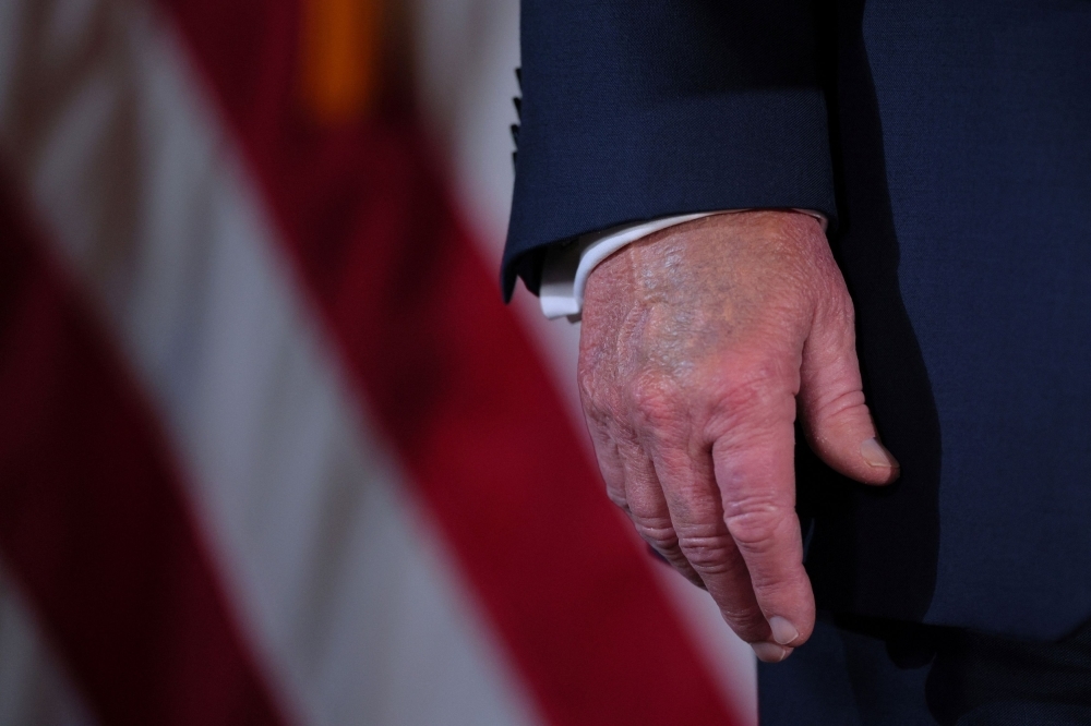No clot, just clout: Trump's bruises from ‘frequent handshaking', says White House