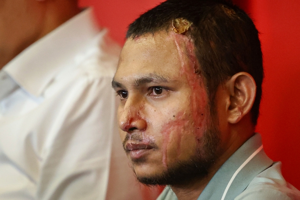 Azalina: NFA classification doesn't mean game over for Faisal Halim acid attack case