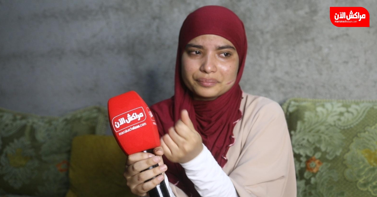 جراح الماضي تنزف مجدداً.. سلمى ضحية تشويه الوجه بمراكش تذرف الدموع 'وليت مشرملة'