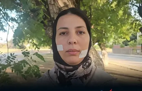 سنتان ونصف سجناً للمتهم بتشويه وجه خديجة وتعويض مالي قدره 20 مليون سنتيم