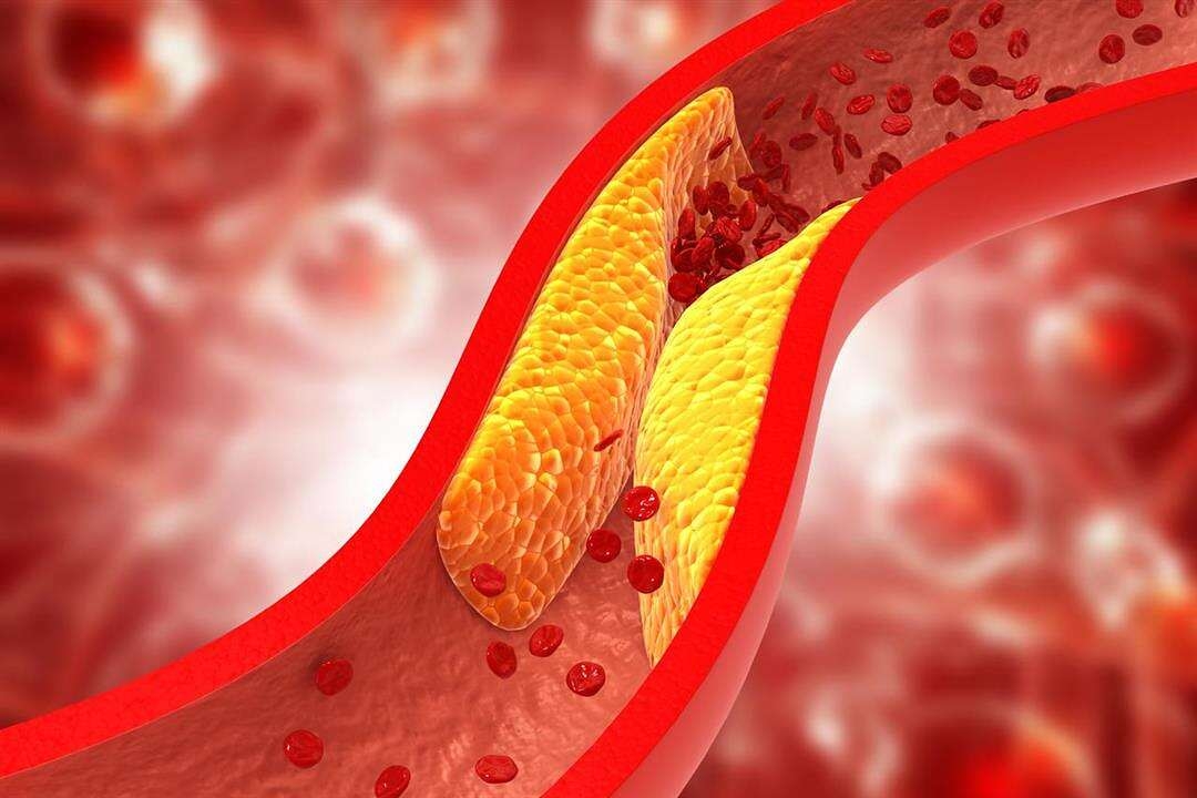 وداعًا للأدوية.. عشبة منزلية "تذيب" الكوليسترول في أسبوع فقط