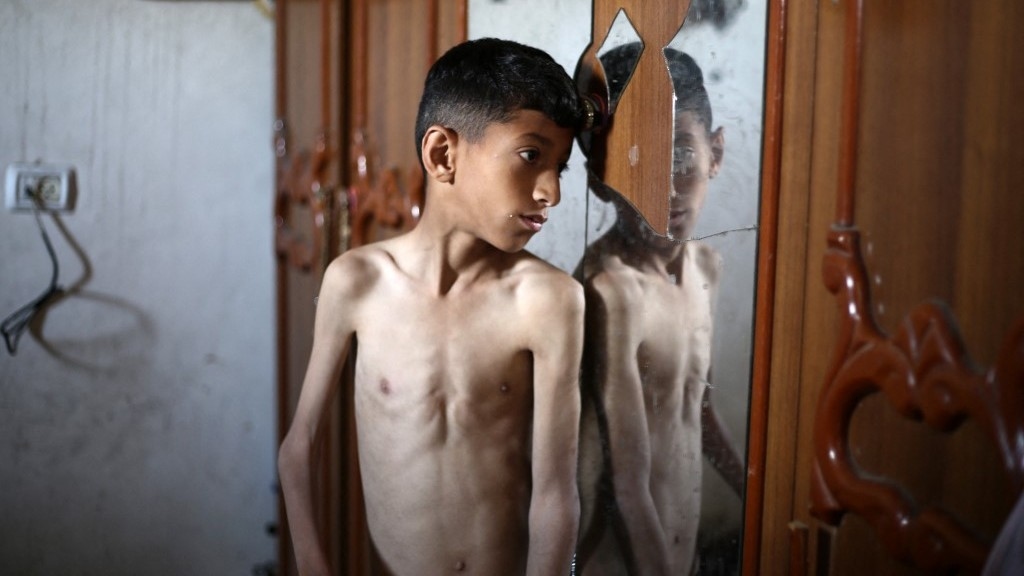 Gaza on brink of famine as UN says Israel is starving civilians