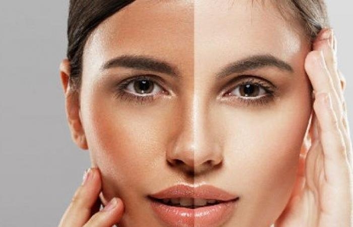 احذر من التعرض المباشر للشمس .. 5 علامات تظهر على بشرتك