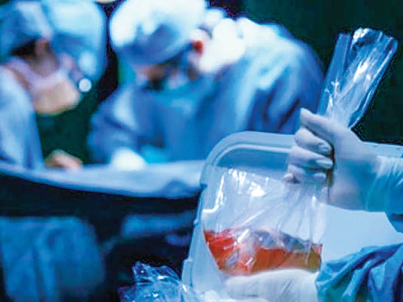 Oman's organ donation law to combat illegal trade, reward donors