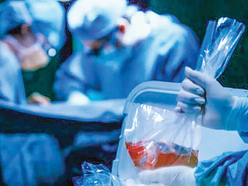 Organ transplants increase as public participation grows in Oman