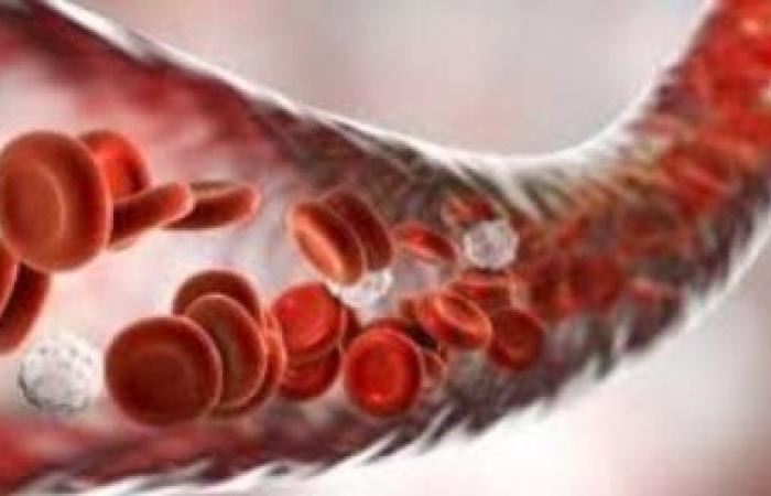 صحة وطب : يعني إيه تسمم الدم وما الأعراض والأسباب وطرق الوقاية؟