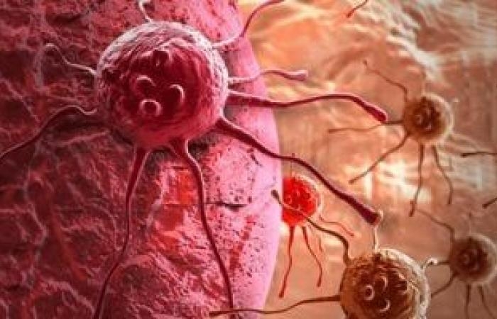 صحة وطب : من مطبخك.. مشروب بسيط يقتل الخلايا السرطانية فى جسمك