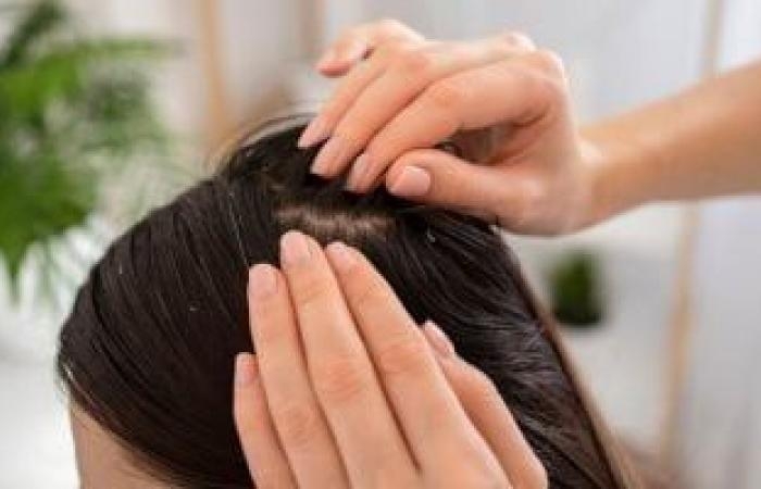 عالم المرأة : وصفات طبيعية للتخلص من قشرة الشعر