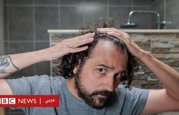 أخبار العالم : هل يمكن وقف تساقط الشعر؟