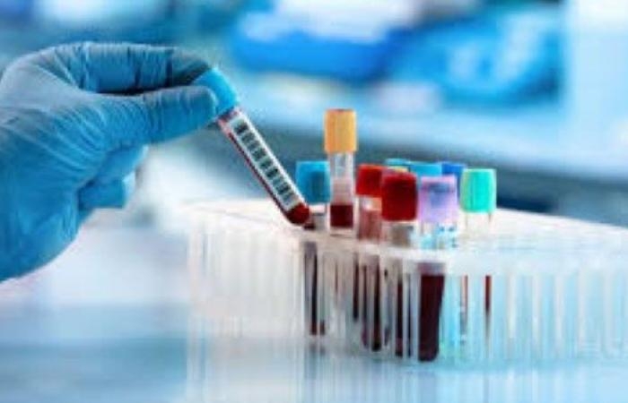 أخبار مصر : الأوراق المطلوبة لـ ترخيص معمل تحاليل طبية